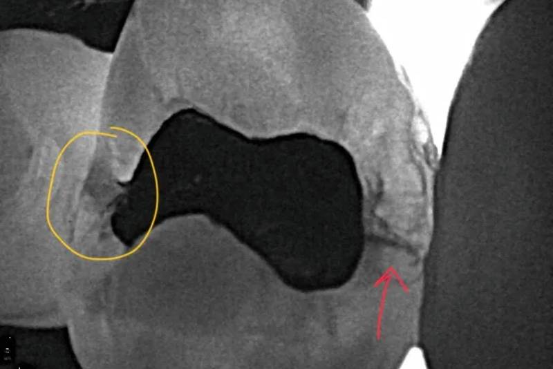 Laser Dentistry in 