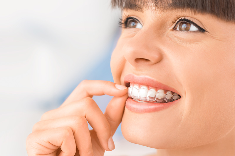 Invisalign in Warrenville