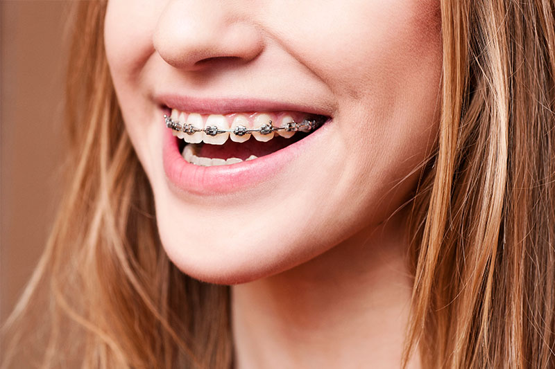 Orthodontics in Warrenville